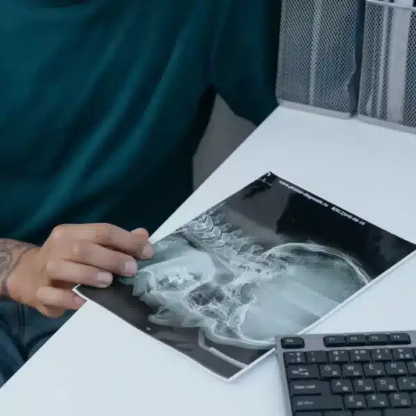 Dentist reviewing a panoramic dental X-ray before root canal treatment