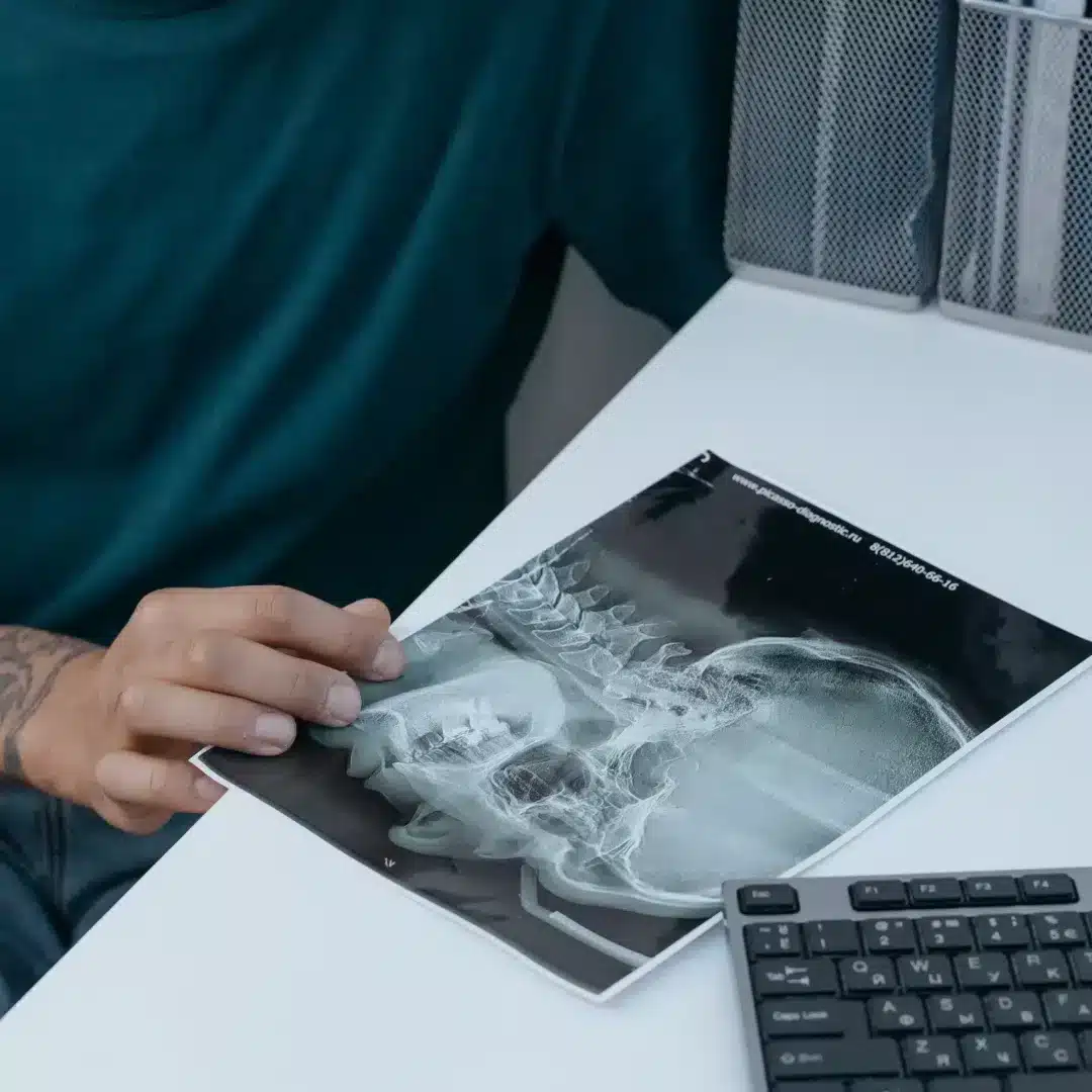 Dentist reviewing a panoramic dental X-ray before root canal treatment