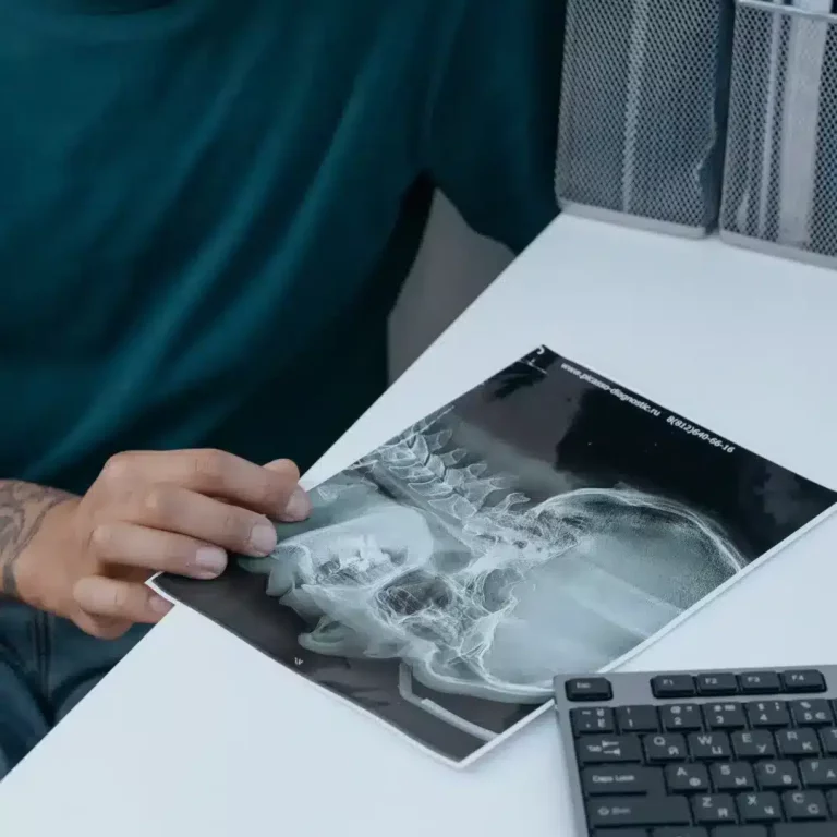Dentist reviewing a panoramic dental X-ray before root canal treatment